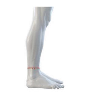 Around Ankle Diagram